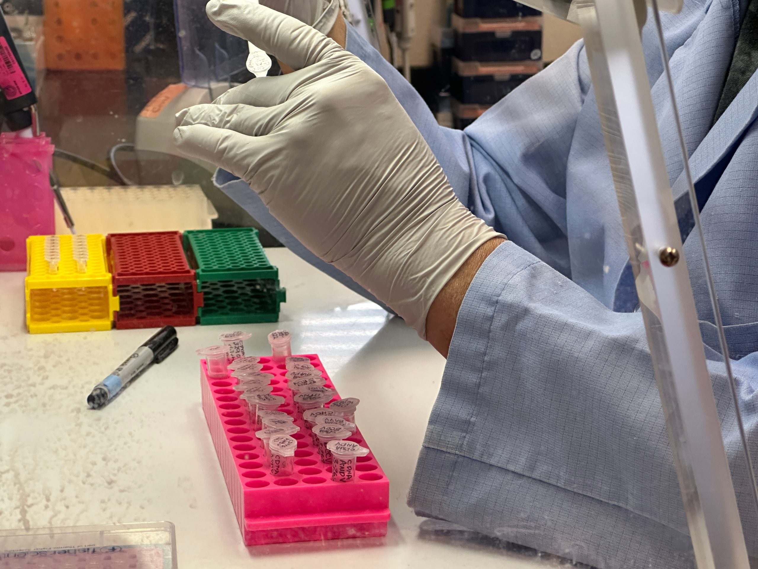 Hantavirus Risk ‘Low’ To Chicagoans, Health Department Says